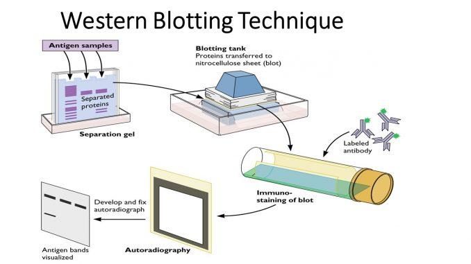 Western Blotting - MyBioSource Learning Center