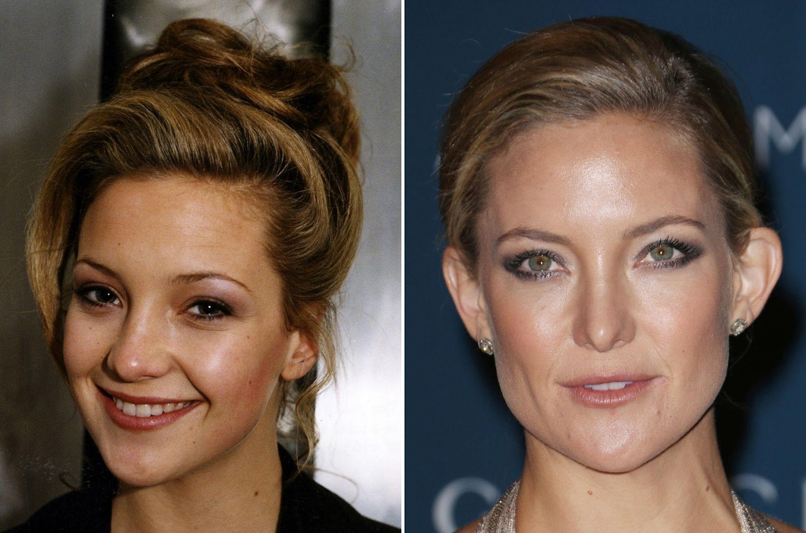 Kate-Hudson-before-and-after-nose-surgery.jpg