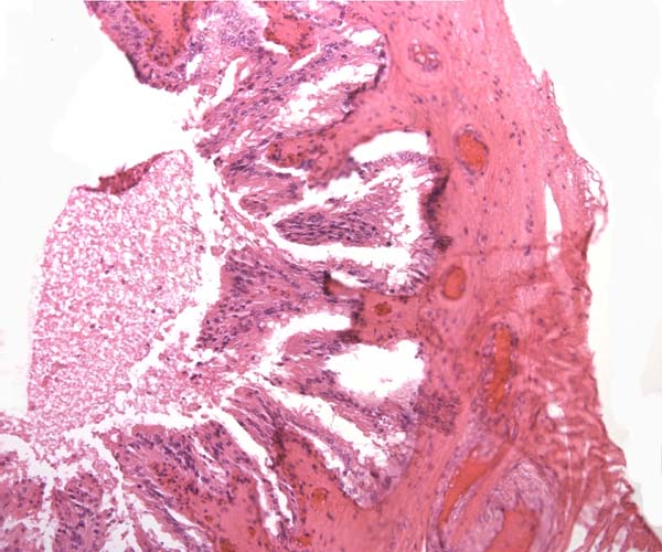 Chorion at right, trophoblast over the intercotyledonary region