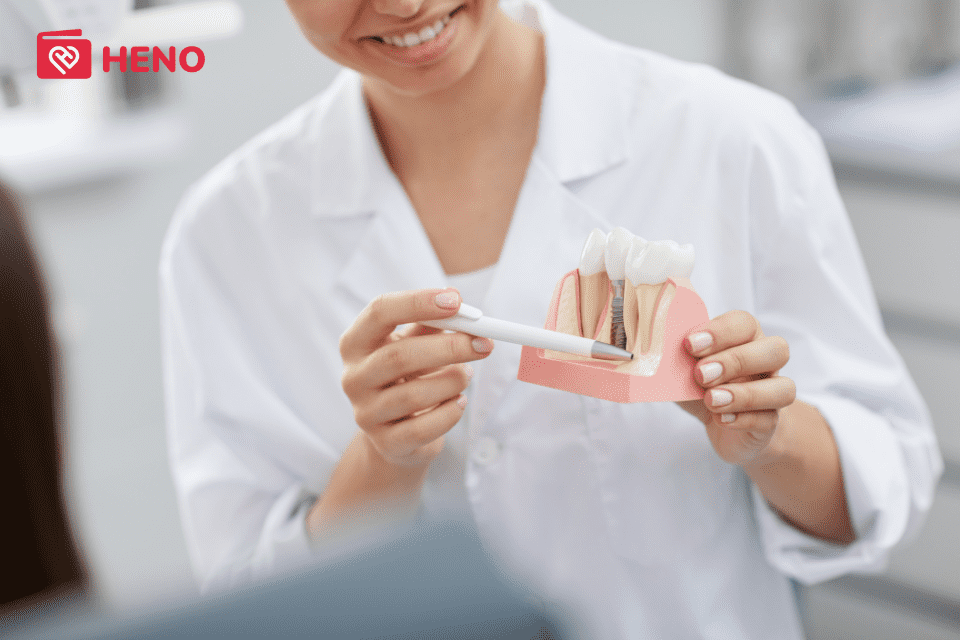 chăm sóc răng sau cấy implant theo chỉ định của bác sĩ