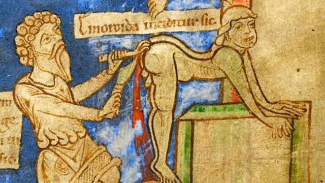 hemorrhoid-treatment-12th-century.jpg