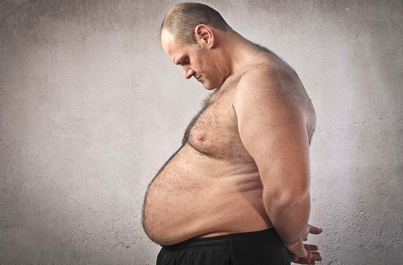 https://www.shimspine.com/wp-content/uploads/2015/05/obesity-surgery-complications.jpg