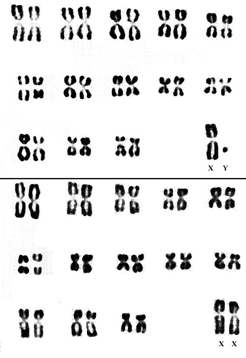Karyotype from Hsu & Benirschke, 1967.