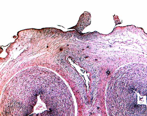 Higher magnification of the central portion of the umbilical cord with allantoic duct and its small vessels, as well as foci of squamous metaplasia