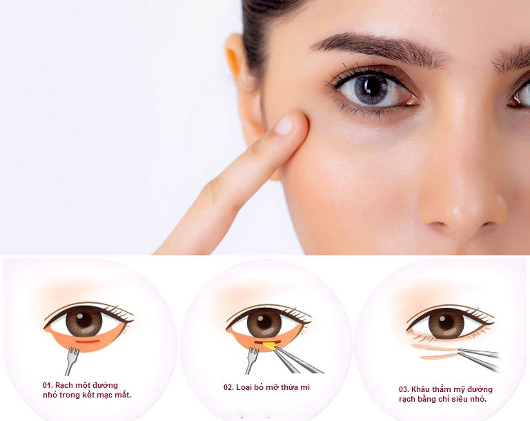 Ngoài tác dụng bảo vệ mắt, mí mắt còn đóng vai trò mang đến sự thẩm mỹ cho đôi mắt, cũng như nét hài hòa trên khuôn mặt.