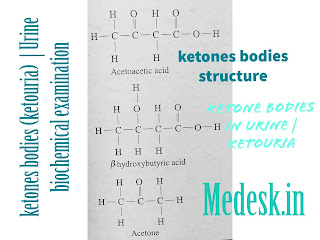 ketones bodies structure  ketouria