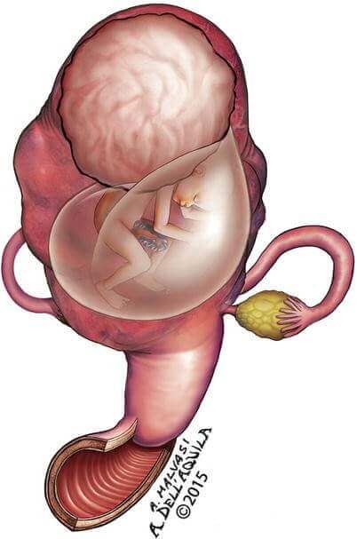  Quá trình thụ tinh và làm tổ của trứng: Chậm có thai hoặc vô sinh