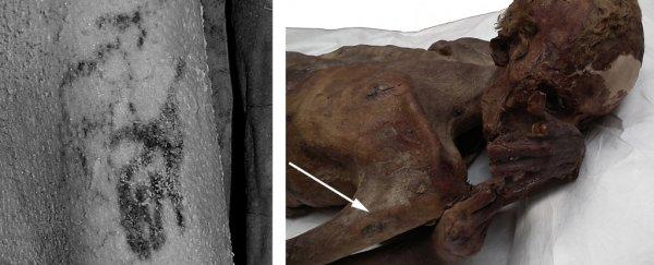 World's Oldest Figural Tattoos Were Just Found on 5,000-Year-Old Egyptian Mummies : ScienceAlert