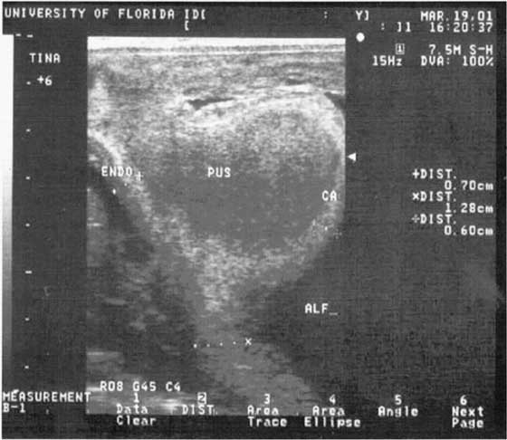 Ultrasonographic image of the caudal reproductive tract of the same mare as in Fig. 11.