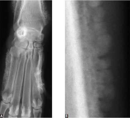 Hypertrophic osteopathy in an adult dog with lung tumors