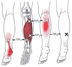 Soleus muscle