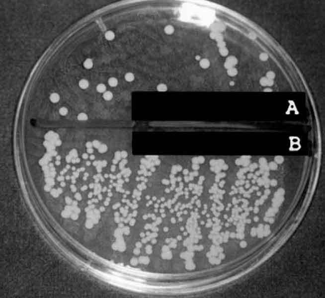 yeast colonies growing on agar plate