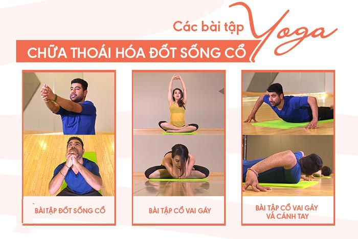 Các bài tập yoga giúp cải thiện tình trạng thoái hóa cột sống cổ