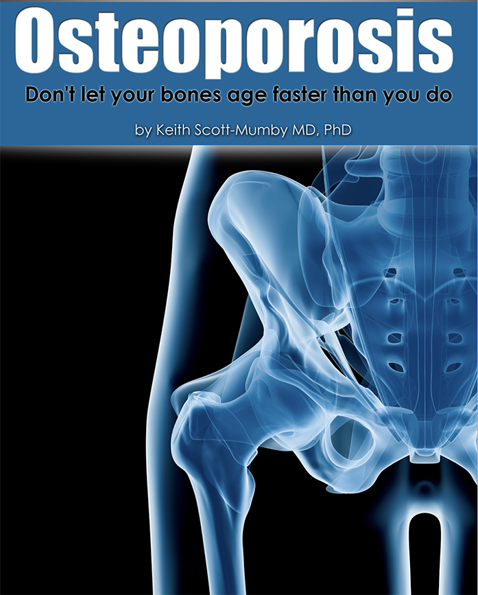 Down The Osteoporosis Report