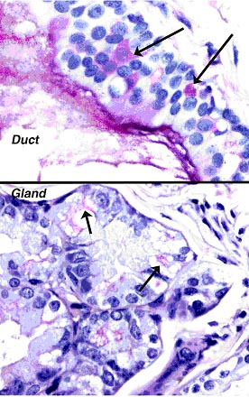 PAS stained gland and duct