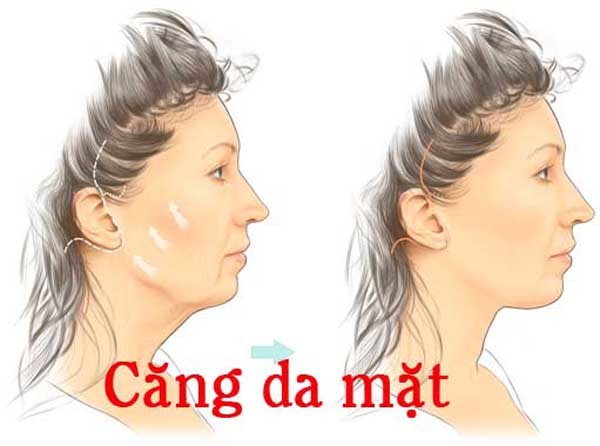 Căng da mặt nội soi áp dụng công nghệ tiên tiến, hiện đại, được thực hiện bởi đội ngũ Y bác sĩ có trình độ, chuyên môn cao.