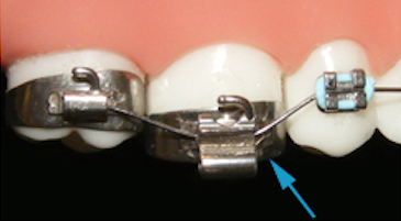 orthodontist-in-richmond-81
