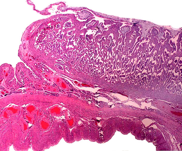 Edge of immature cotyledon attached to myometrium below. The intercotyledonary endometrium is folded and glandular. The ingrowths of villi (purple-blue centers) from chorioallantoic membrane are obvious