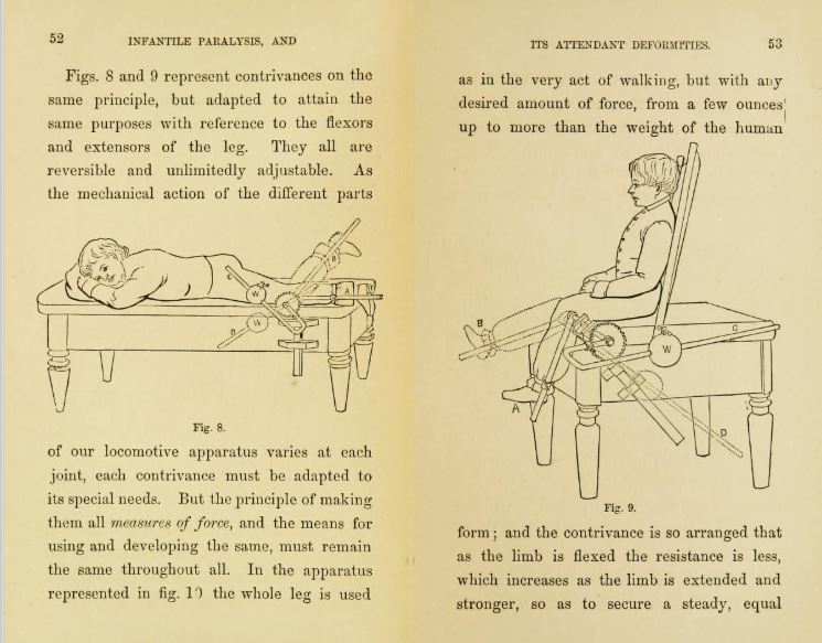 Source: Charles F. Taylor, Infantile Paralysis and its Attendant Deformities. Philadelphia: J.B. Lippincott & Co., 1867. Diagrams from p. 52-53. 
