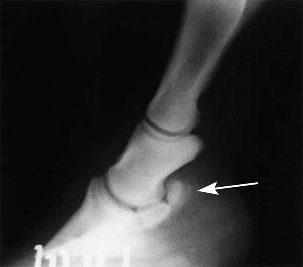 To verify centesis of the navicular bursa, 0.5 - 1 mL sterile, water-soluble radiocontrast solution can be administered along with the drug
