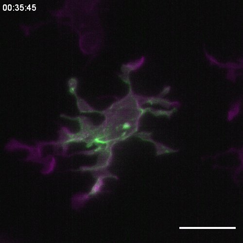 Cytoskeletal dynamics using microglia efferocytosis. Image data are available in the BioImage Archive