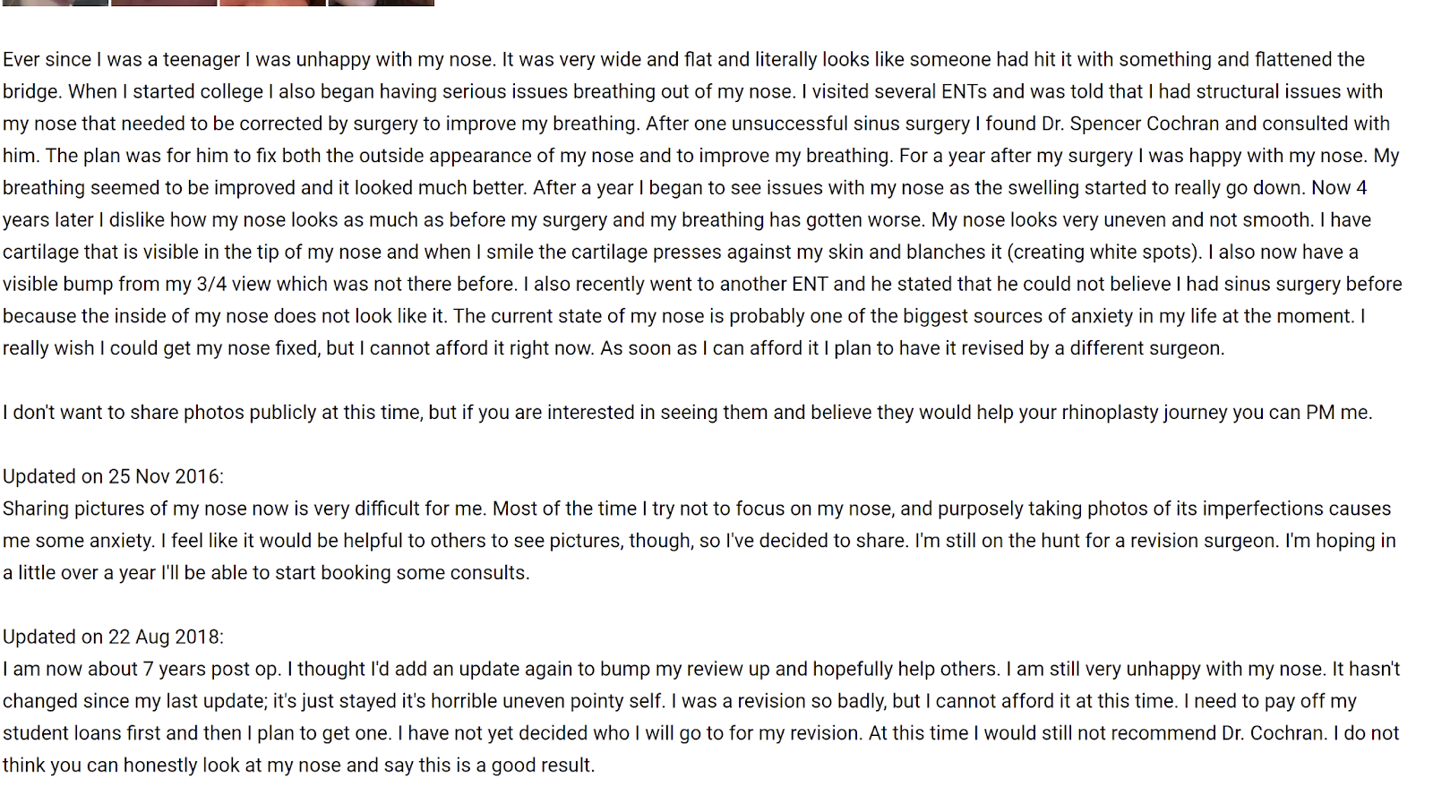 Dallas Rhinoplasty Center review