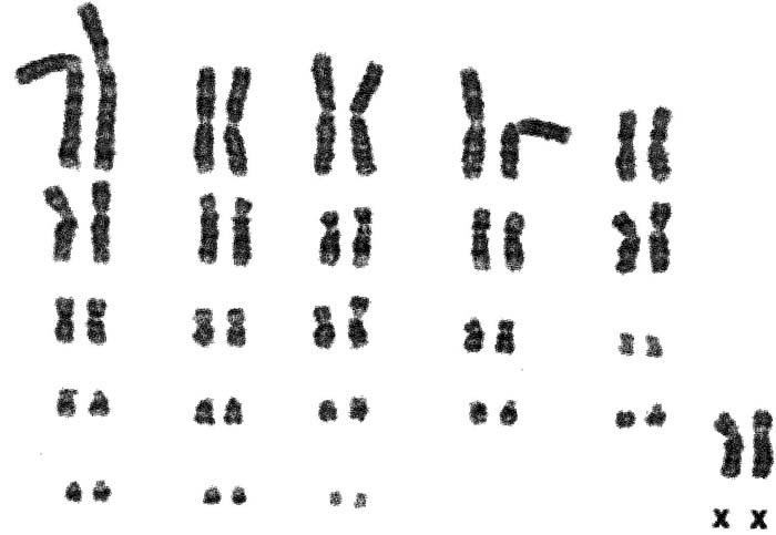Female sifaka chromosome set from CRES, as published by O’Brien et al. (2006).