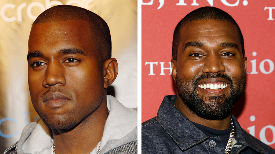 25 Celebs With And Without Beards | iHeart