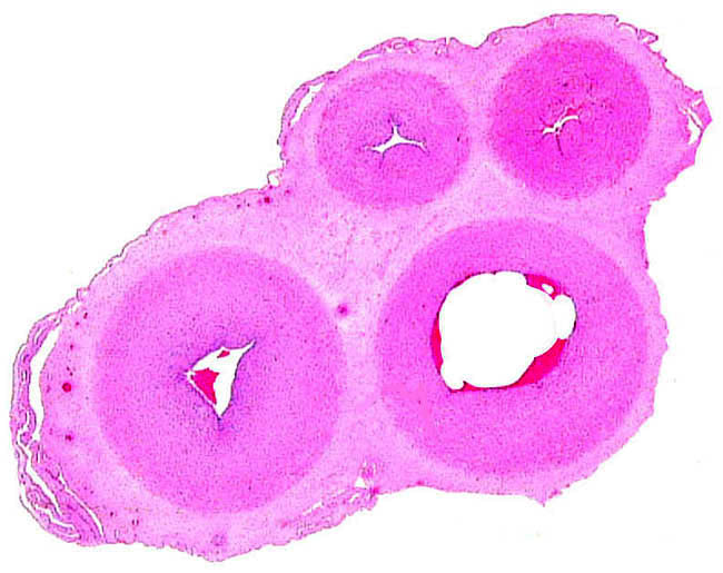 Cross section of umbilical cord