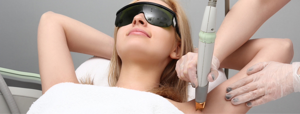 Laser hair removal