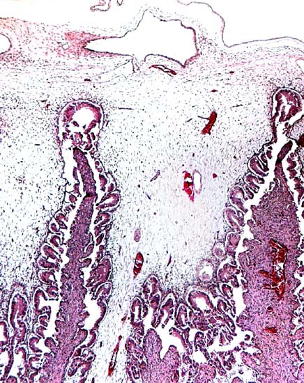 Fetal surface of implanted pronghorn placenta with purple tips of maternal tissue seen between the paler villi