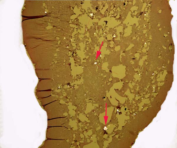 Hippomanes in allantoic sac with crystals (arrows) under polarized light