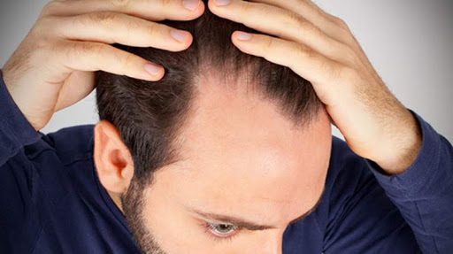 Comment le stress peut accélérer la chute des cheveux: nos conseils pour la  limiter.
