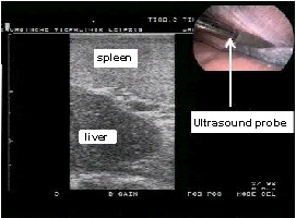 Laparoscopía ultrasonográfica del hígado izquierdo y el bazo en un equino en decúbito.