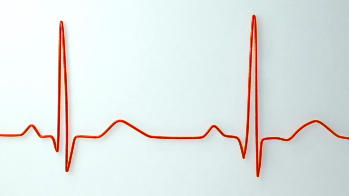 What is A Normal Resting Heart Rate? | Elemental