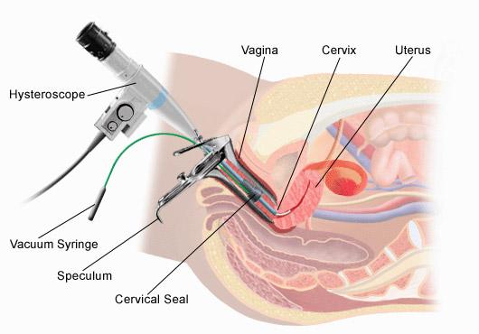 http://www.gynecologistkolkata.net/cimage30/110622pic35.jpg