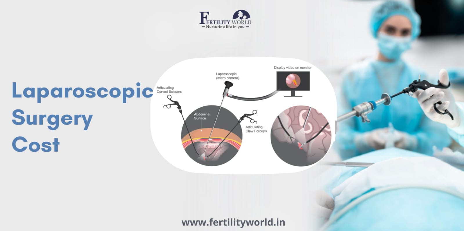 Detailed Cost of Laparoscopic Surgery of Gallbladder Diseases