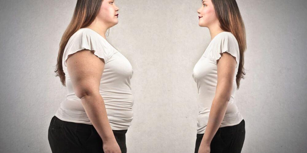 Comparaison avant et après une chirurgie de l'obésité