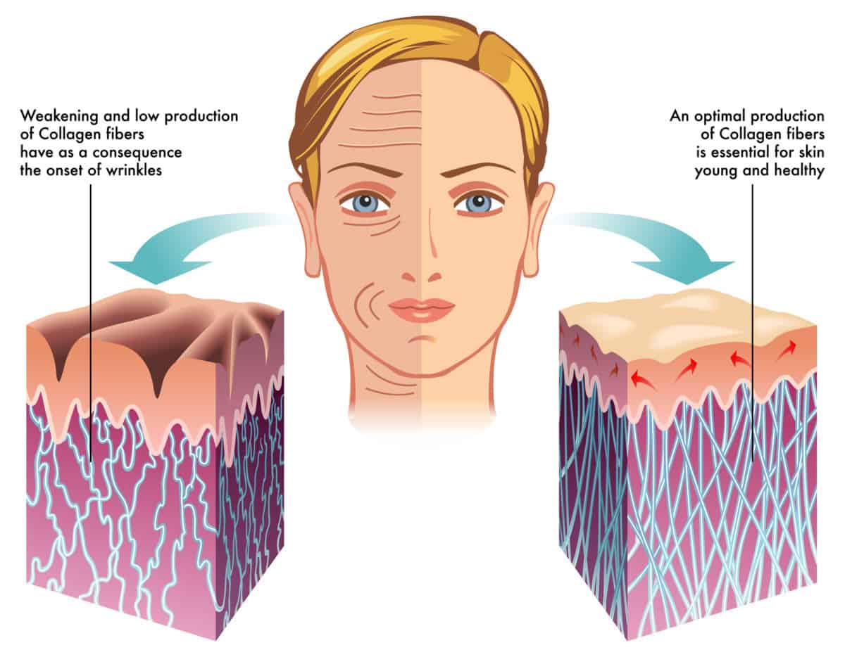 collagen old vs young skin