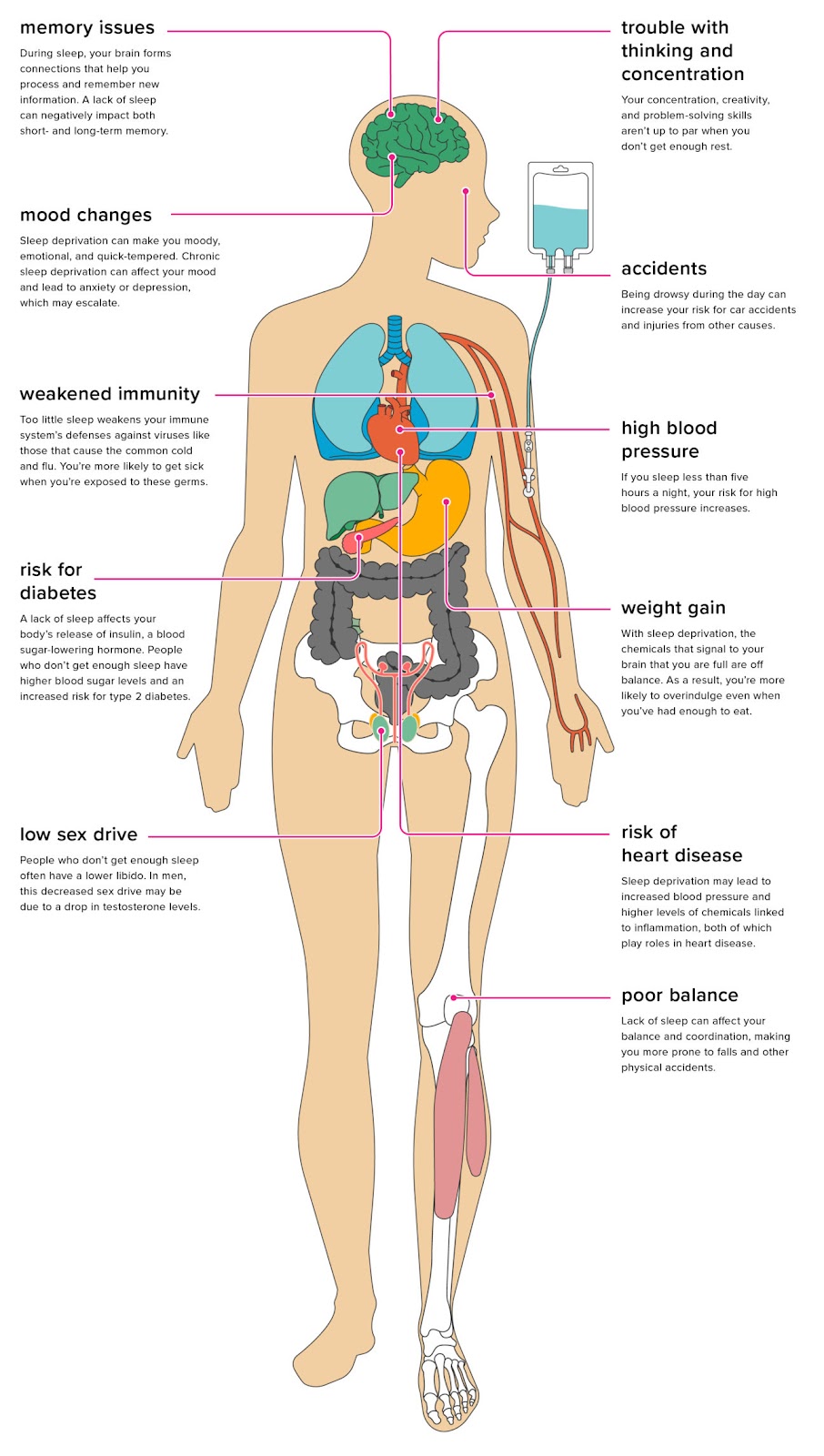 workplace fatigue symptoms