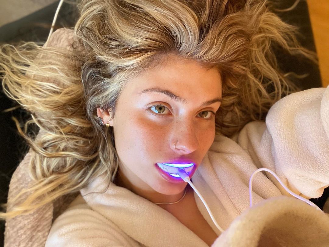 Teeth whitening with novashine