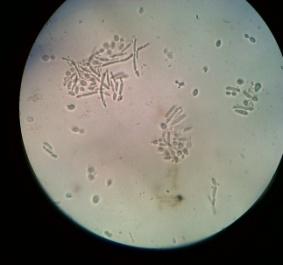F:\GAMBAR percobaan 7\gambar sawi\sawi 15 persen.jpg