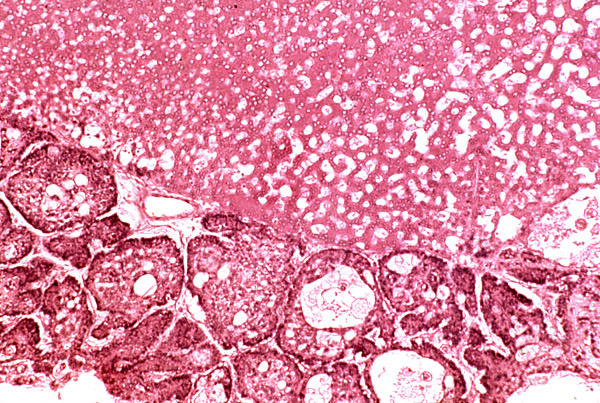 Edge of trophospongium and border to syncytium in a mature placenta.