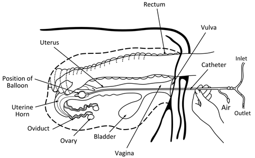 In vivo collection of embryos in water buffalo. Rectal canal is cleaned. A Foley catheter is inserted to the vagina and guided through the cervix up to the uterine horn. Air is introduced into the air inlet using a syringe to inflate the balloon. Flushing medium is introduced into the inlet enough to fill the uterine horn. The uterine horn is then massaged gently to allow the embryos to float then the flushing medium is drawn to the outlet to collect the embryos. (Illustration drawing by Perry Irish Hufana Duran).