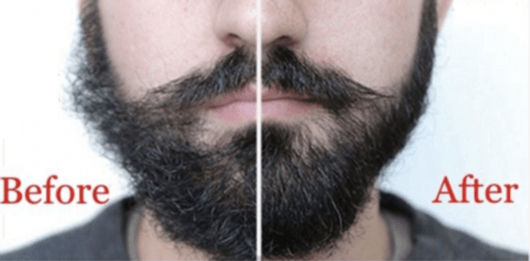 Before and After picture