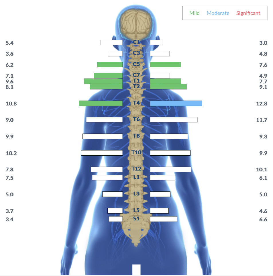 High functioning anxiety scan (after)