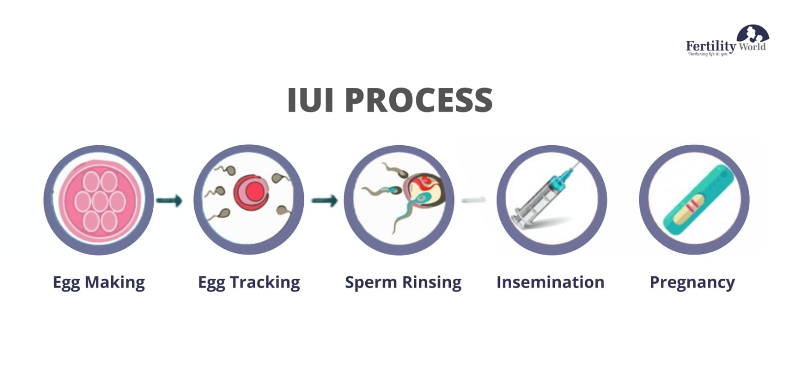 Process of Intrauterine Insemination (IUI) 
