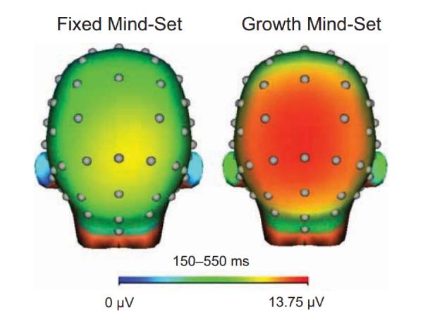 Imagem mostra atividade cerebral diante do erro de Mentalidade Fixa x Mentalidade de Crescimento