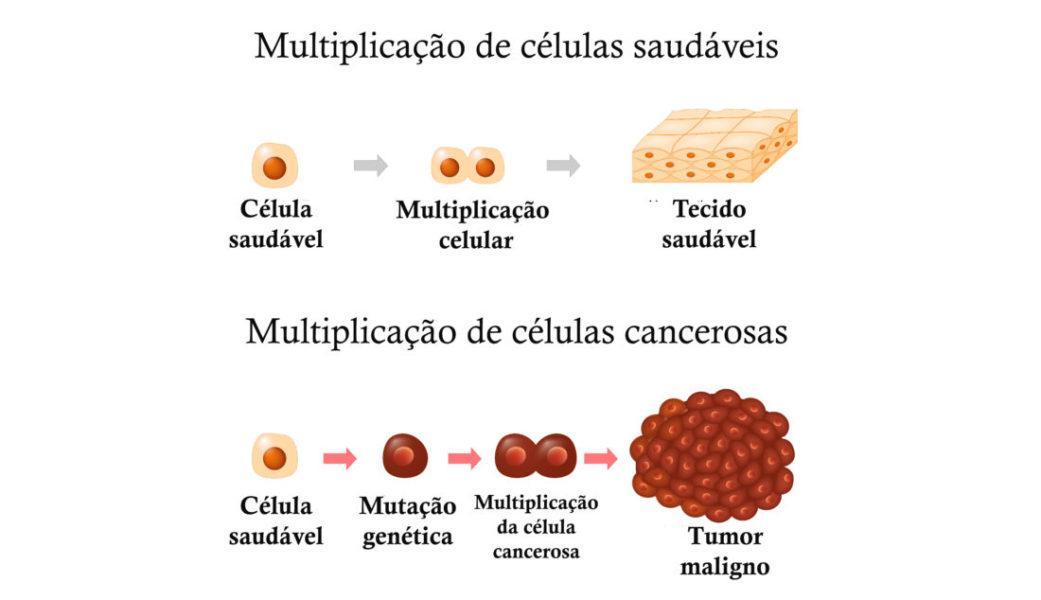 Desenvolvimento do câncer: quanto tempo leva? - Revista Online ABRALE