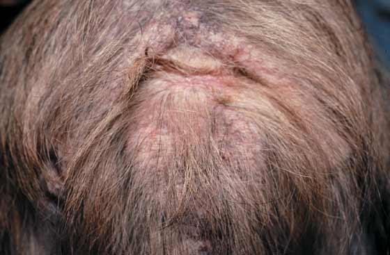 Alopecia y liquenificación de la base de la cola en un macho cruza de Lhasa Apso, de 1 año de edad, con hipersensibilidad a las mordeduras de pulga